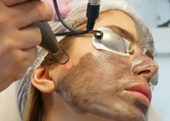 Что такое карбоновый пилинг лица и основные правила