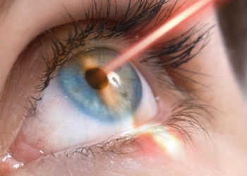 Технология коррекции зрения лазером и советы