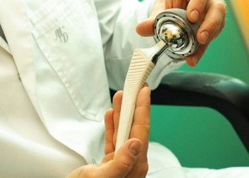 Особенности эндопротезирования тазобедренного сустава