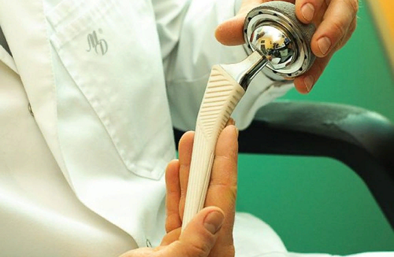 Особенности эндопротезирования тазобедренного сустава