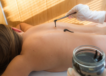 Пиявки для здоровья: виды, требования и выбор