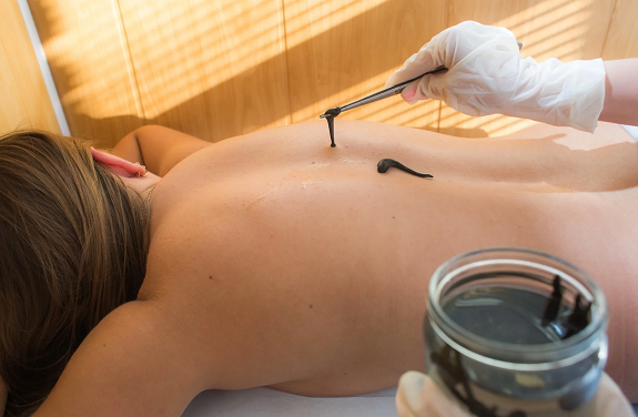 Пиявки для здоровья: виды, требования и выбор