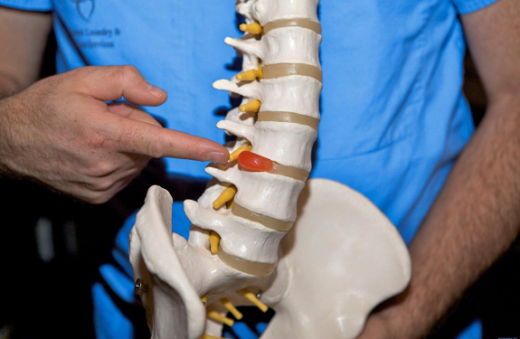 Межпозвоночные грыжи: понятие, симптомы и методы лечения