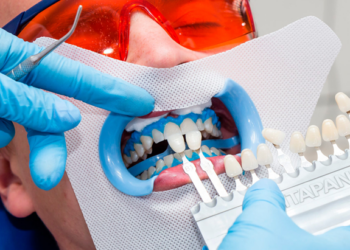 Рекомендации по безопасному отбеливанию зубов в стоматологии